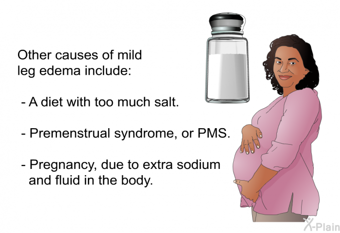 Other causes of mild leg edema include:  A diet with too much salt. Premenstrual syndrome, or PMS. Pregnancy, due to extra sodium and fluid in the body.