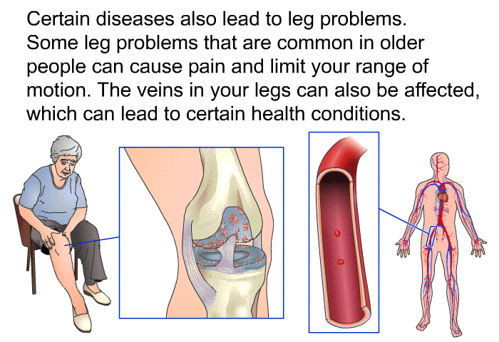 Certain diseases also lead to leg problems. Some leg problems that are common in older people can cause pain and limit your range of motion. The veins in your legs can also be affected, which can lead to certain health conditions.