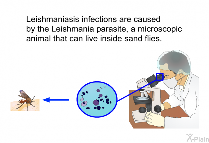 Leishmaniasis infections are caused by the Leishmania parasite, a microscopic animal that can live inside sand flies.