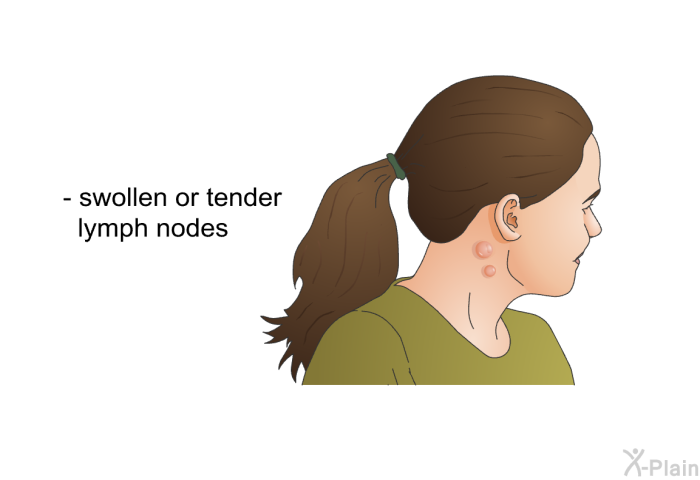 swollen or tender lymph<I> </I>nodes