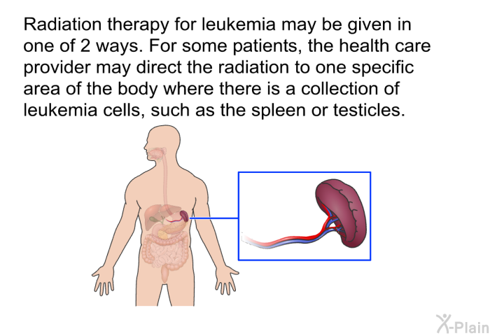 Radiation therapy for leukemia may be given in one of 2 ways. For some patients, the health care provider may direct the radiation to one specific area of the body where there is a collection of leukemia cells, such as the spleen or testicles.