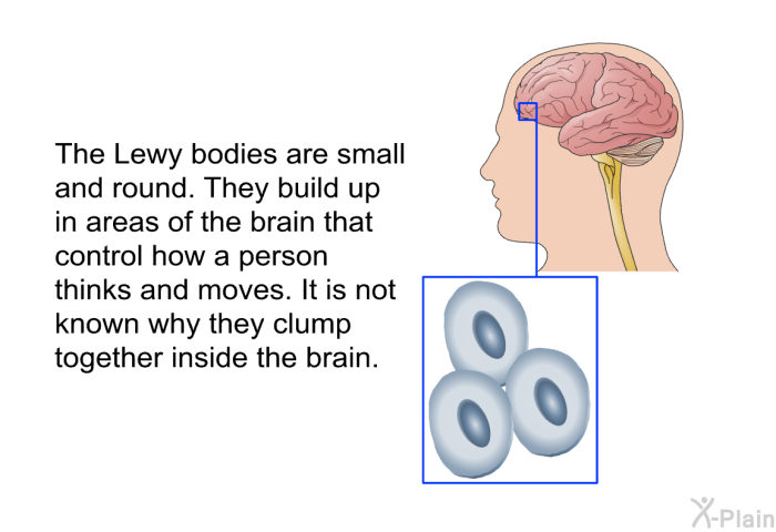 The Lewy bodies are small and round. They build up in areas of the brain that control how a person thinks and moves. It is not known why they clump together inside the brain.