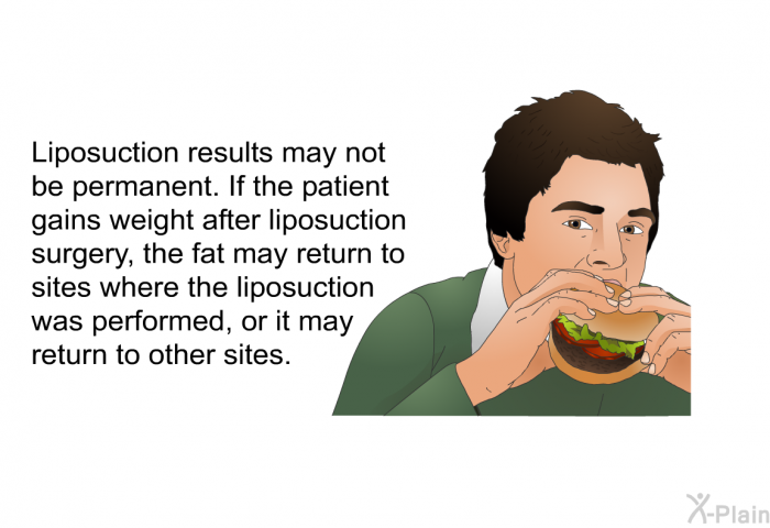 Liposuction results may not be permanent. If the patient gains weight after liposuction surgery, the fat may return to sites where the liposuction was performed, or it may return to other sites.