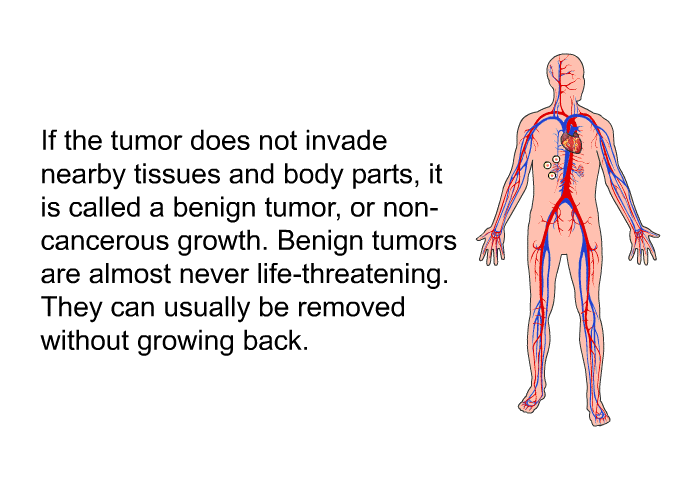 If the tumor does not invade nearby tissues and body parts, it is called a benign tumor, or non-cancerous growth. Benign tumors are almost never life-threatening. They can usually be removed without growing back.