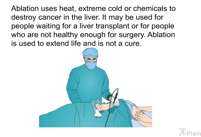 Ablation uses heat, extreme cold or chemicals to destroy cancer in the liver. It may be used for people waiting for a liver transplant or for people who are not healthy enough for surgery. Ablation is used to extend life and is not a cure.