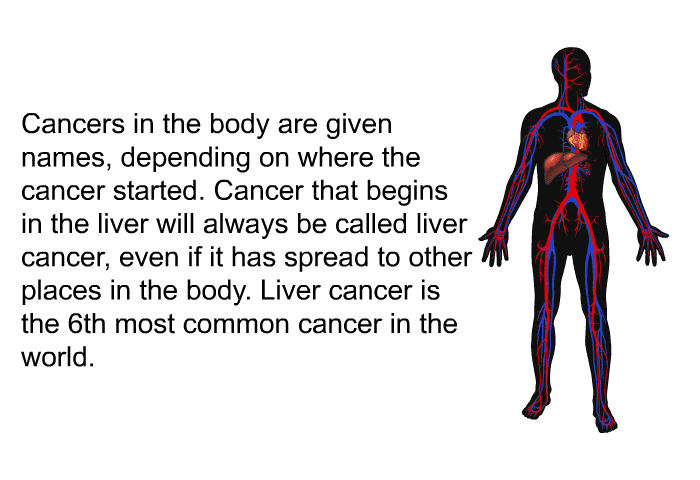 Cancers in the body are given names, depending on where the cancer started. Cancer that begins in the liver will always be called liver cancer, even if it has spread to other places in the body. Liver cancer is the 6<SUP>th</SUP> most common cancer in the world.