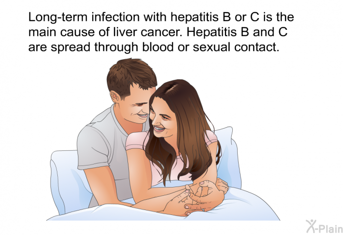 Long-term infection with hepatitis B or C is the main cause of liver cancer. Hepatitis B and C are spread through blood or sexual contact.