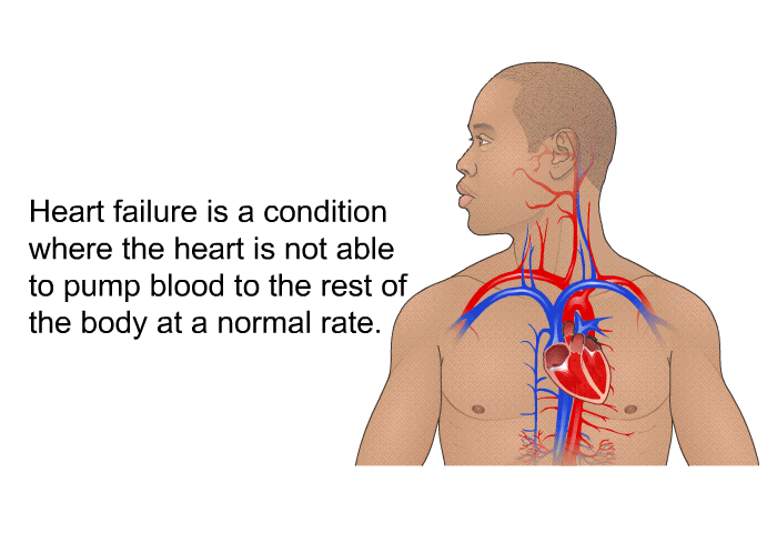 Heart failure is a condition where the heart is not able to pump blood to the rest of the body at a normal rate.
