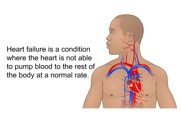 PatEdu Living With Congestive Heart Failure