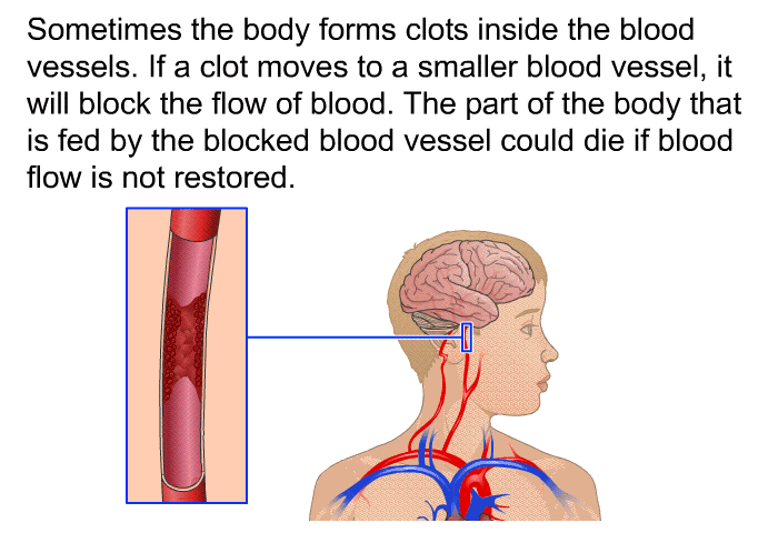 Sometimes the body forms clots inside the blood vessels. If a clot moves to a smaller blood vessel, it will block the flow of blood. The part of the body that is fed by the blocked blood vessel could die if blood flow is not restored.