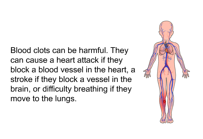 Blood clots can be harmful. They can cause a heart attack if they block a blood vessel in the heart, a stroke if they block a vessel in the brain, or difficulty breathing if they move to the lungs.