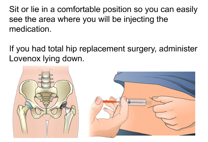 Sit or lie in a comfortable position so you can easily see the area where you will be injecting the medication. If you had total hip replacement surgery, administer Lovenox lying down.