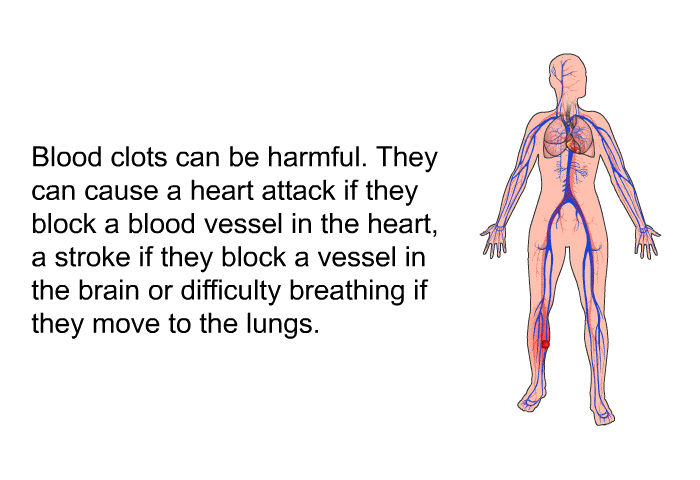 Blood clots can be harmful. They can cause a heart attack if they block a blood vessel in the heart, a stroke if they block a vessel in the brain or difficulty breathing if they move to the lungs.