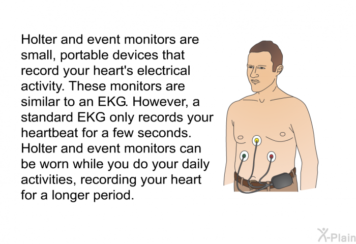 Holter and event monitors are small, portable devices that record your heart's electrical activity. These monitors are similar to an EKG. However, a standard EKG only records your heartbeat for a few seconds. Holter and event monitors can be worn while you do your daily activities, recording your heart for a longer period.