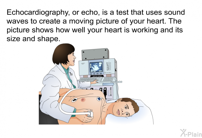 Echocardiography, or echo, is a test that uses sound waves to create a moving picture of your heart. The picture shows how well your heart is working and its size and shape.