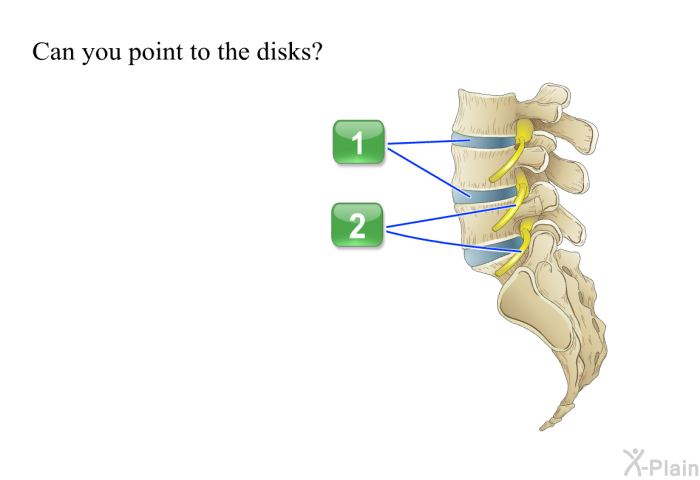 Can you point to the disks?