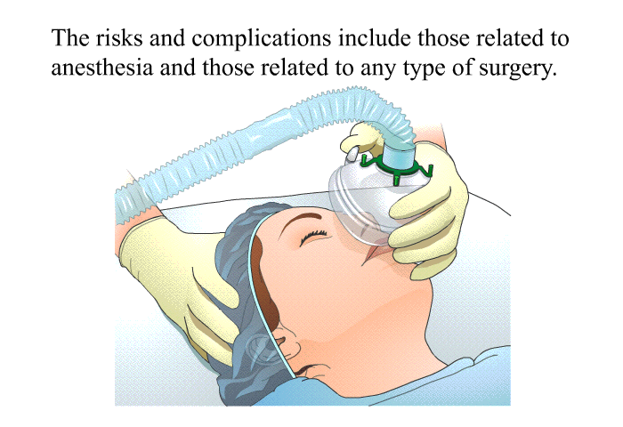 The risks and complications include those related to anesthesia and those related to any type of surgery.