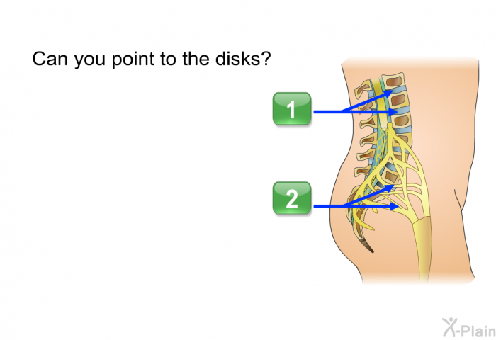 Can you point to the disks? Choose one of the following options.