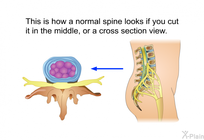 This is how a normal spine looks if you cut it in the middle, or a cross section view.