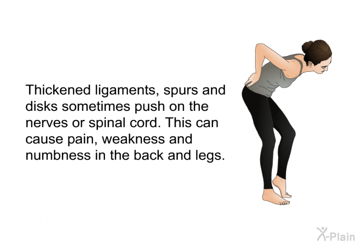 Thickened ligaments, spurs and disks sometimes push on the nerves or spinal cord. This can cause pain, weakness and numbness in the back and legs.