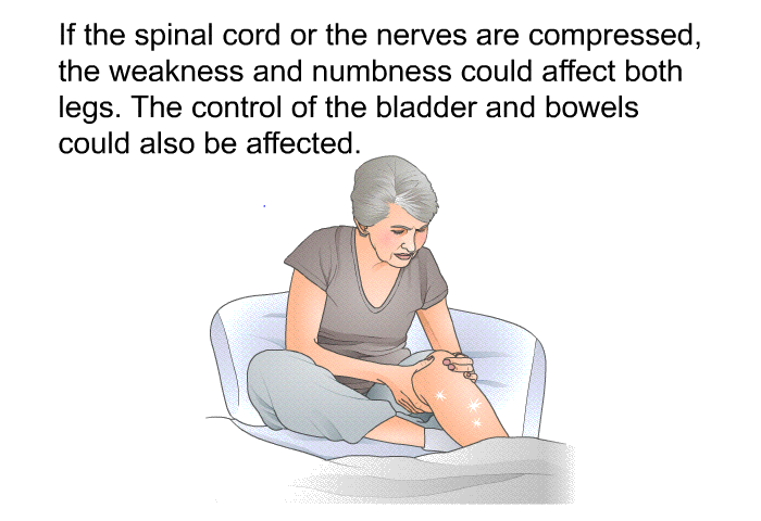 If the spinal cord or the nerves are compressed, the weakness and numbness could affect both legs. The control of the bladder and bowels could also be affected.