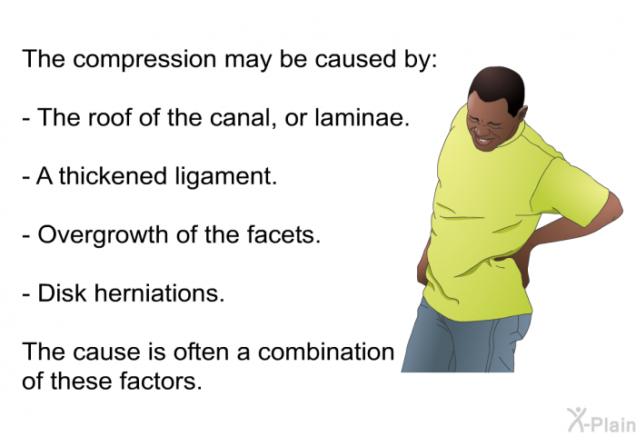 The compression may be caused by:  The roof of the canal, or laminae. A thickened ligament. Overgrowth of the facets. Disk herniations.  
 The cause is often a combination of these factors.