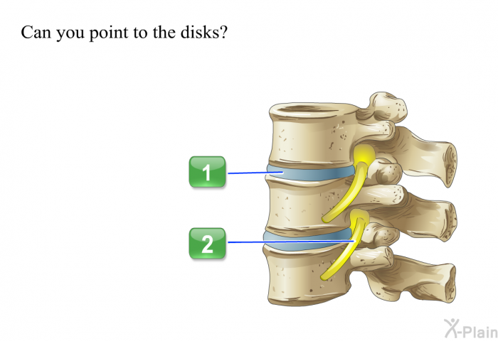 Can you point to the disks?