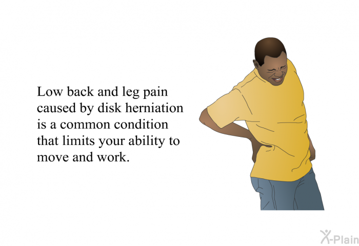 Low back and leg pain caused by disk herniation is a common condition that limits your ability to move and work.