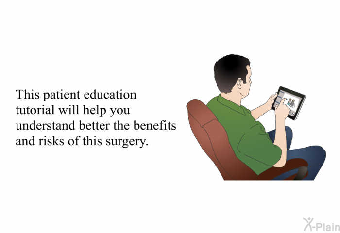 This patient education tutorial will help you understand better the benefits and risks of this surgery.
