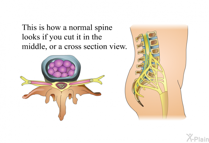 This is how a normal spine looks if you cut it in the middle, or a cross section view.