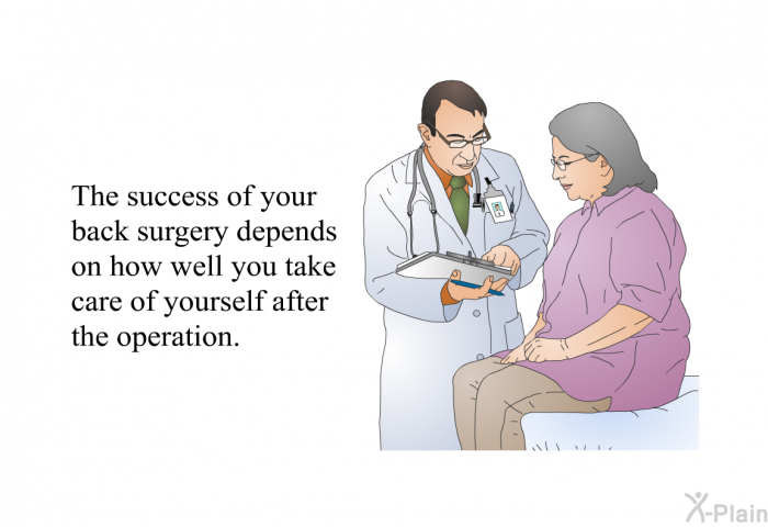 The success of your back surgery depends on how well you take care of yourself after the operation.