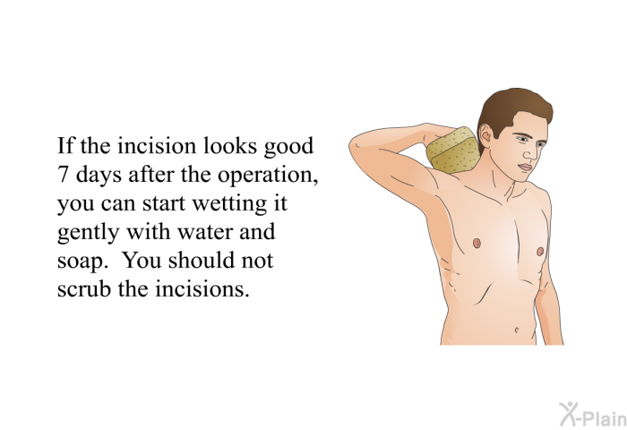 If the incision looks good 7 days after the operation, you can start wetting it gently with water and soap. You should not scrub the incisions.