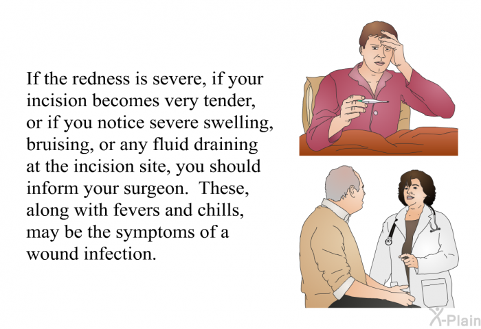 If the redness is severe, if your incision becomes very tender, or if you notice severe swelling, bruising, or any fluid draining at the incision site, you should inform your surgeon. These, along with fevers and chills, may be the symptoms of a wound infection.