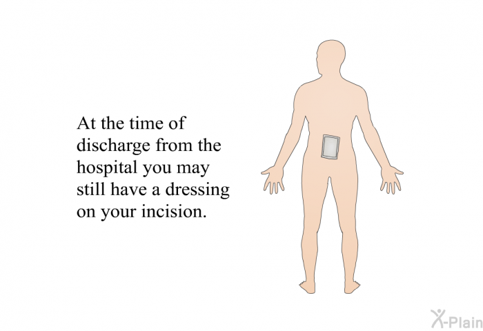 At the time of discharge from the hospital you may still have a dressing on your incision.