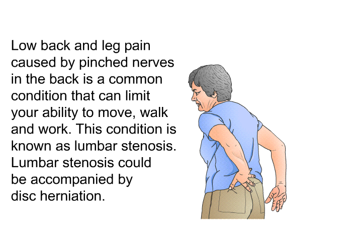 Low back and leg pain caused by pinched nerves in the back is a common condition that can limit your ability to move, walk and work. This condition is known as lumbar stenosis. Lumbar stenosis could be accompanied by disc herniation.