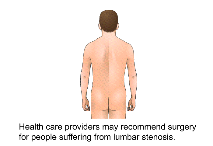 Health care providers may recommend surgery for people suffering from lumbar stenosis.