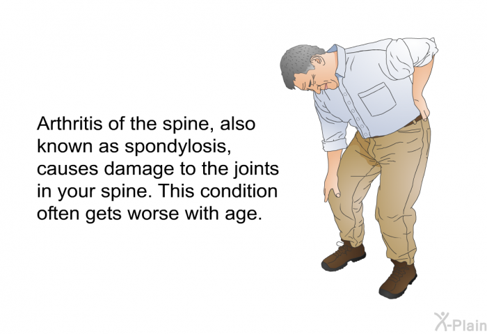 Arthritis of the spine, also known as spondylosis, causes damage to the joints in your spine. This condition often gets worse with age.
