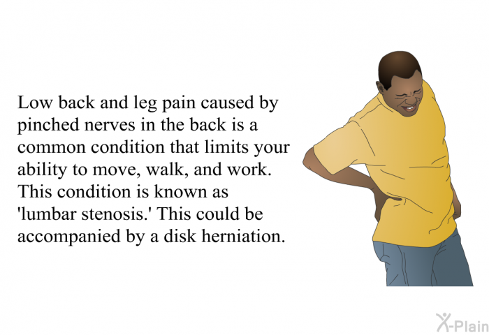 Low back and leg pain caused by pinched nerves in the back is a common condition that limits your ability to move, walk, and work. This condition is known as  lumbar stenosis.' This could be accompanied by a disk herniation.