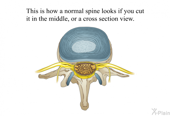 This is how a normal spine looks if you cut it in the middle, or a cross section view.