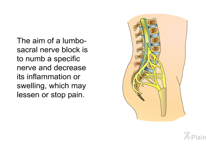 The aim of a lumbo-sacral nerve block is to numb a specific nerve and decrease its inflammation or swelling, which may lessen or stop pain.