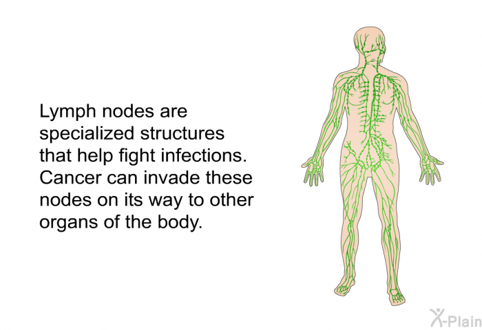 Lymph nodes are specialized structures that help fight infec­tions. Cancer can invade these nodes on its way to other organs of the body.