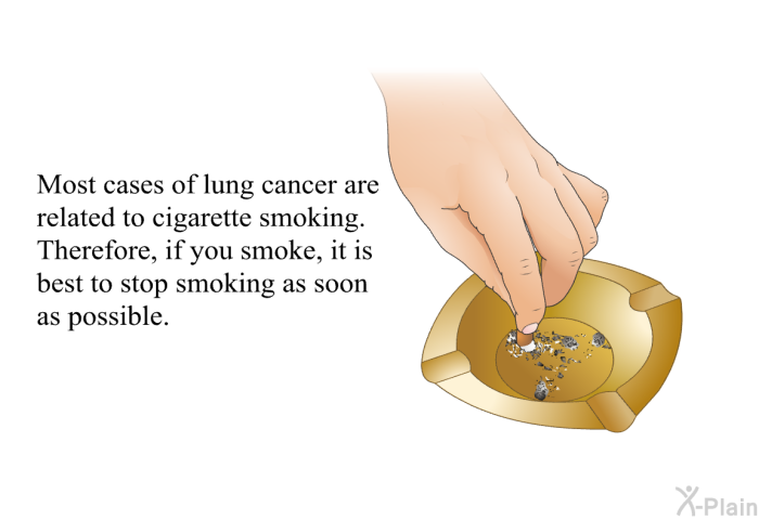 Most cases of lung cancer are related to cigarette smoking. Therefore, if you smoke, it is best to stop smoking as soon as possible.