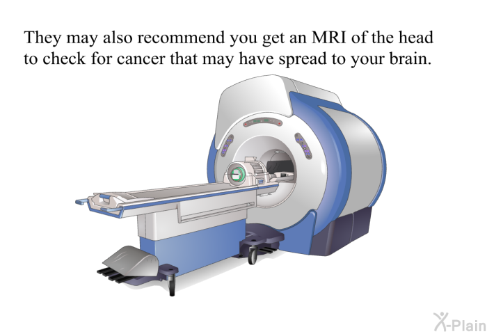 They may also recommend you get an MRI of the head to check for cancer that may have spread to your brain.