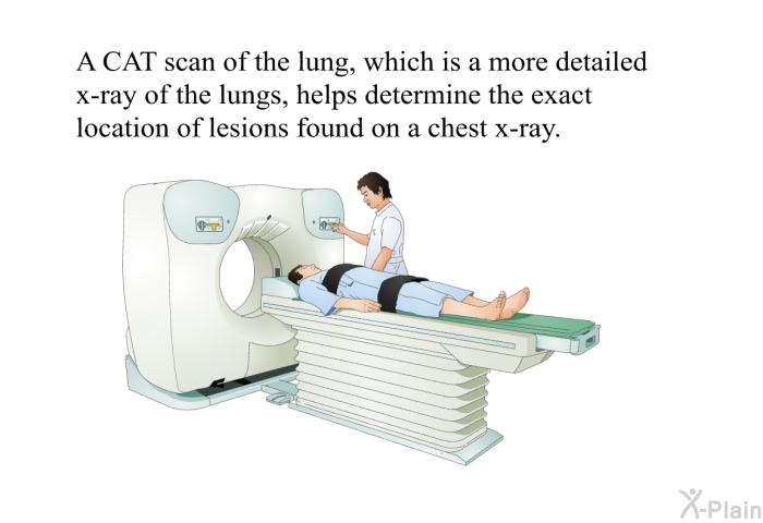 A CAT scan of the lung, which is a more detailed x-ray of the lungs, helps determine the exact location of lesions found on a chest x-ray.