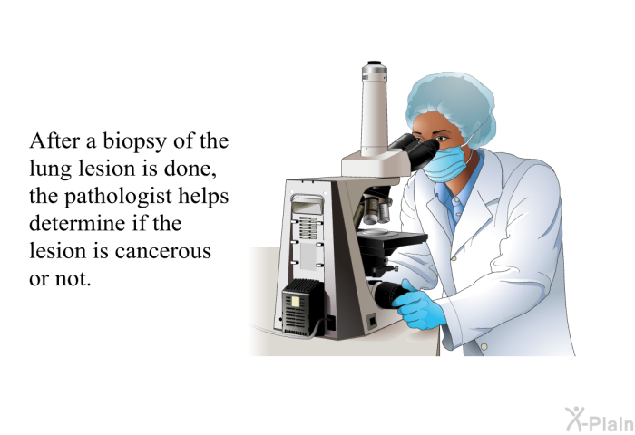 After a biopsy of the lung lesion is done, the pathologist helps determine if the lesion is cancerous or not.