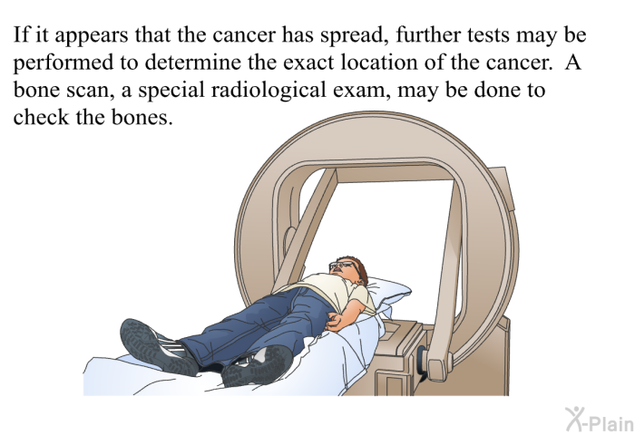 If it appears that the cancer has spread, further tests may be performed to determine the exact location of the cancer. A bone scan, a special radiological exam, may be done to check the bones.
