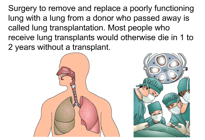 Surgery to remove and replace a poorly functioning lung with a lung from a donor who passed away is called lung transplantation. Most people who receive lung transplants would otherwise die in 1 to 2 years without a transplant.