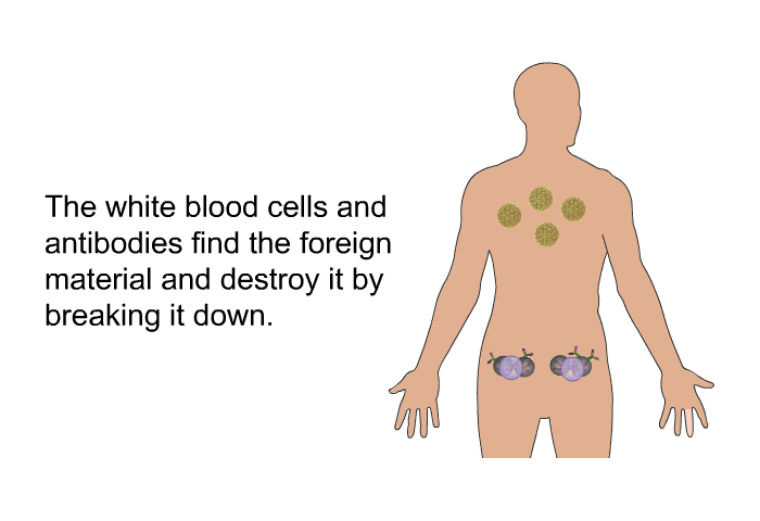 The white blood cells and antibodies find the foreign material and destroy it by breaking it down.