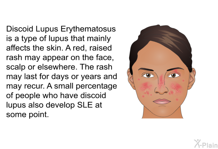 Discoid Lupus Erythematosus is a type of lupus that mainly affects the skin. A red, raised rash may appear on the face, scalp or elsewhere. The rash may last for days or years and may recur. A small percentage of people who have discoid lupus also develop SLE at some point.