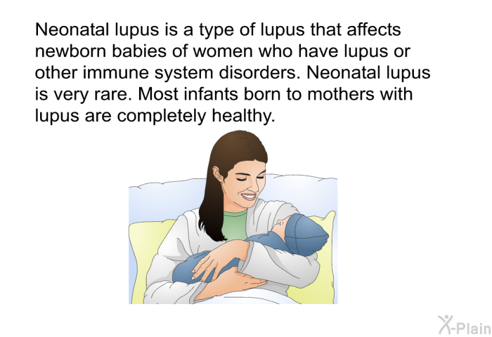 Neonatal lupus is a type of lupus that affects newborn babies of women who have lupus or other immune system disorders. Neonatal lupus is very rare. Most infants born to mothers with lupus are completely healthy.